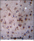 TMED2 Antibody (N-term)